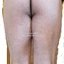 sorconaNAP