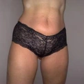 adt33