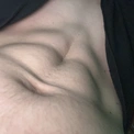 matteort
