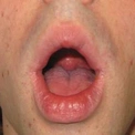 Oralsex3TO