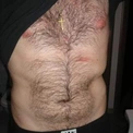 acnabalocsecnarf