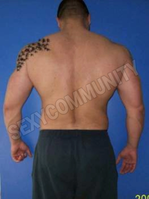 porxello285331135