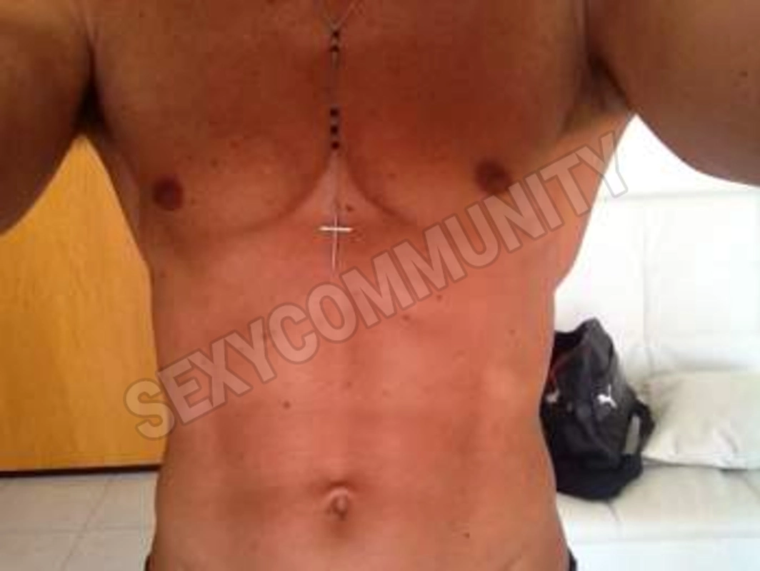 cercopanciact5545835