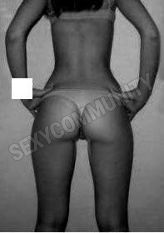 morettabsx5606200