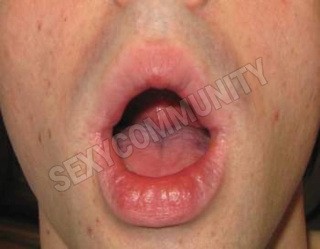 Oralsex3TO5550209