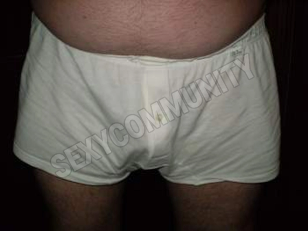 arantonof5525811