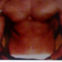 sexomane