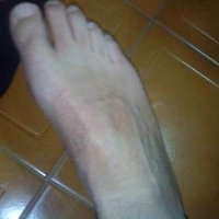 cura