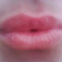 micia72