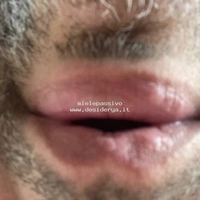 mielepassivo