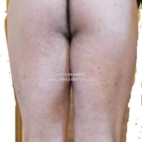 sorconaNAP