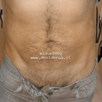 minus2002