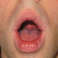 Oralsex3TO
