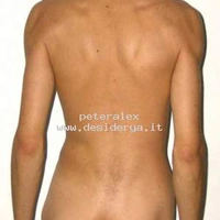 peteralex
