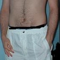 marco981
