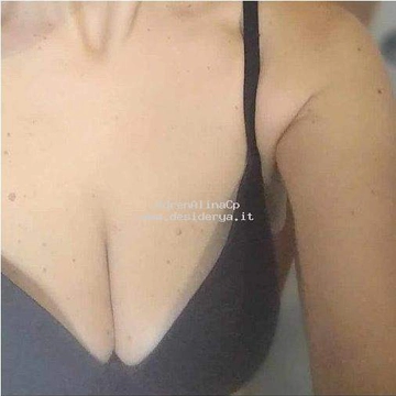 AdrenAlinaCp