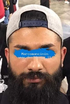 Marcomancinin