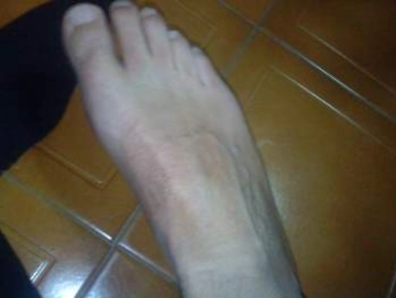 cura