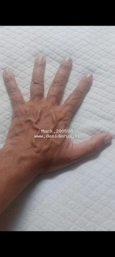 Mark4200590