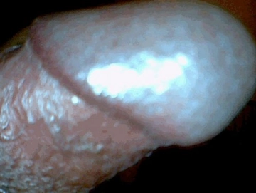 gonfioeduro