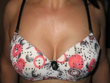 lesa