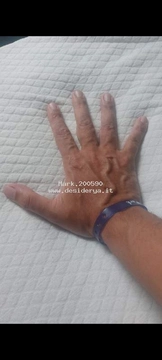 Mark4200590
