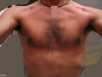gi8