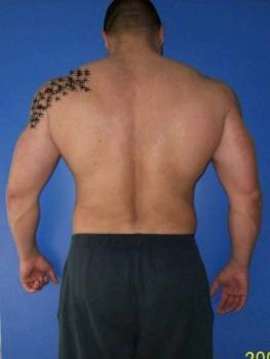 porxello28