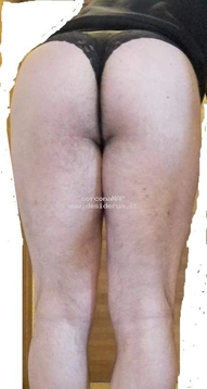 sorconaNAP