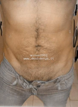 minus2002
