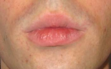Oralsex3TO