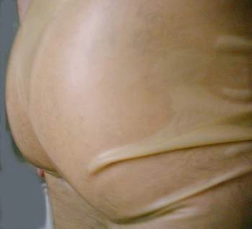 latexa
