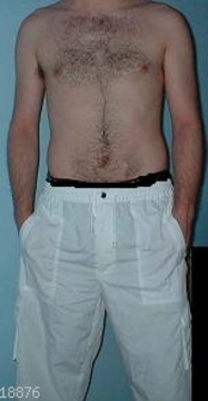 marco981