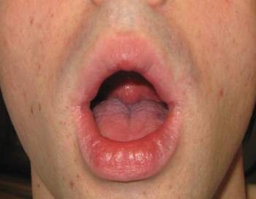 Oralsex3TO