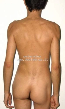 peteralex